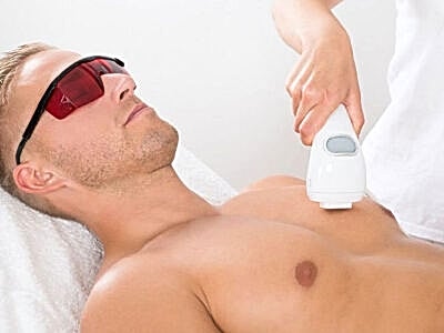 Male Laser Hair Removal