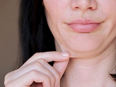 Non-Surgical Double Chin Removal